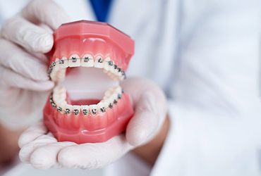 Model teeth with braces